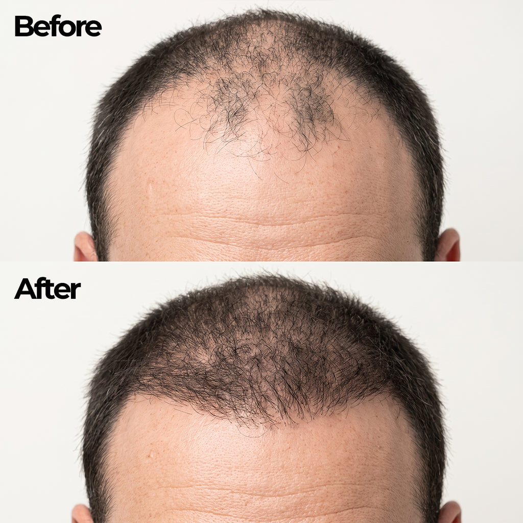 Korean Hair Growth Bar for Men