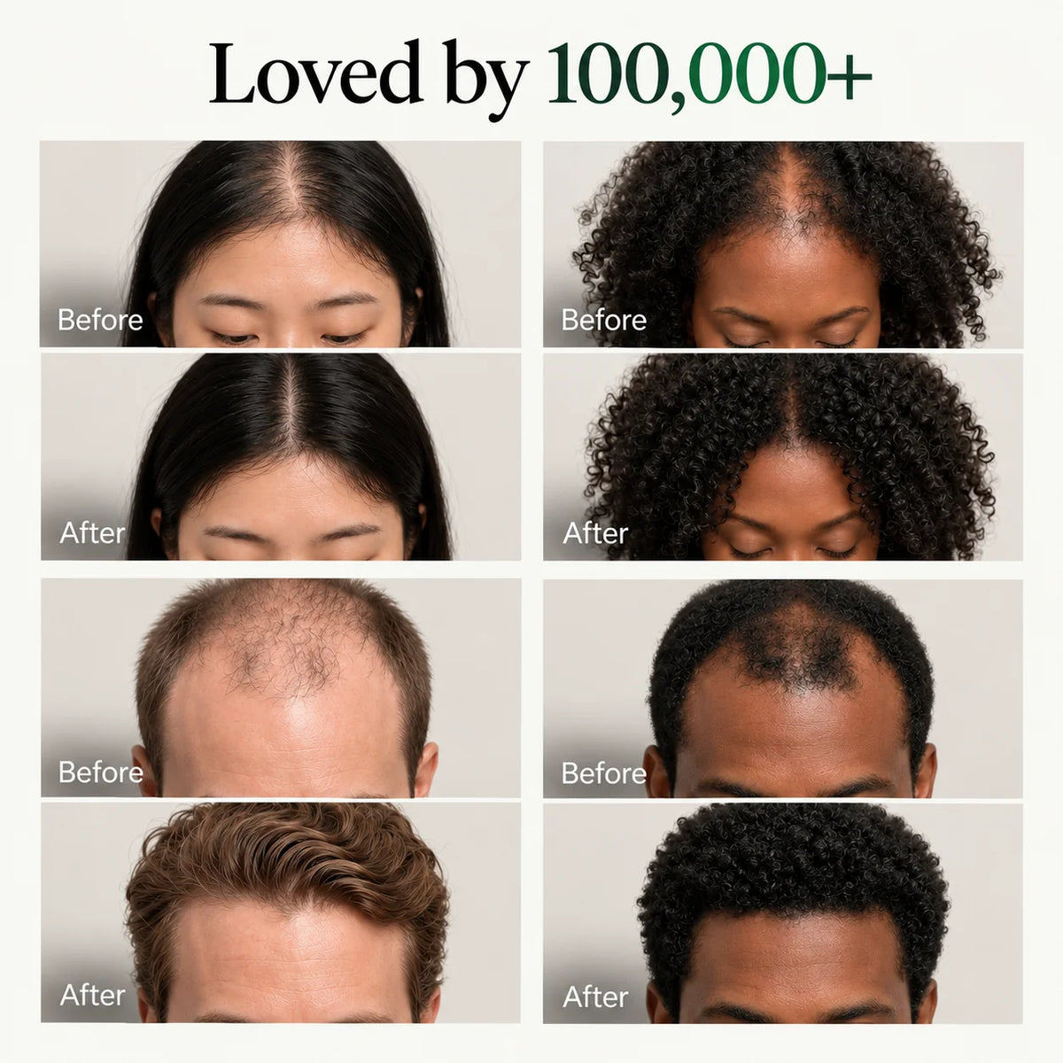 The Korean Scalp Revival Bar