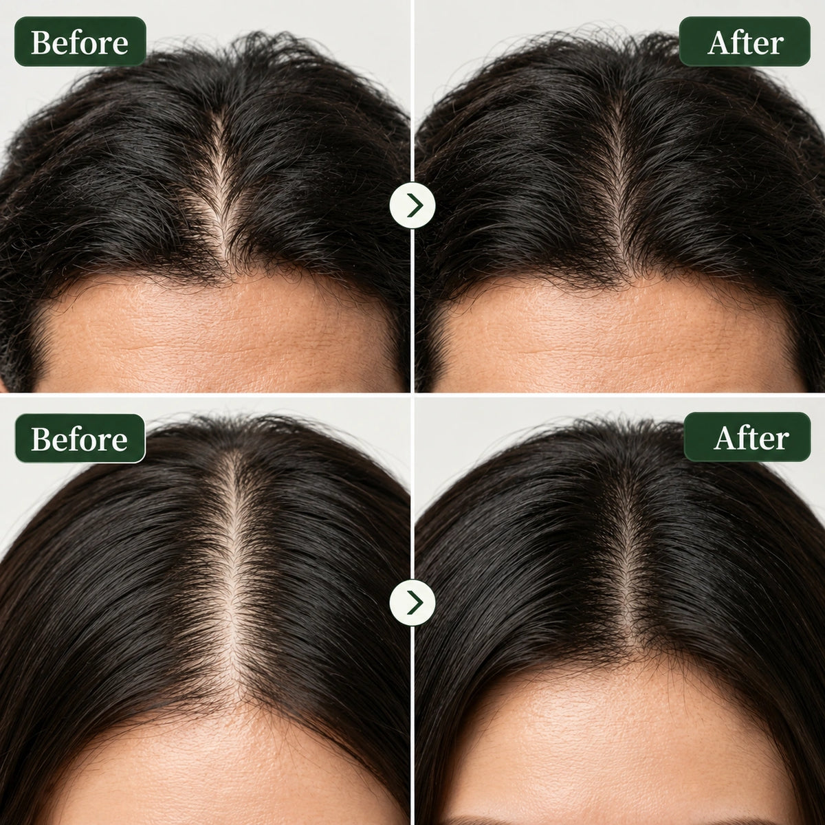 The Korean Scalp Revival Bar