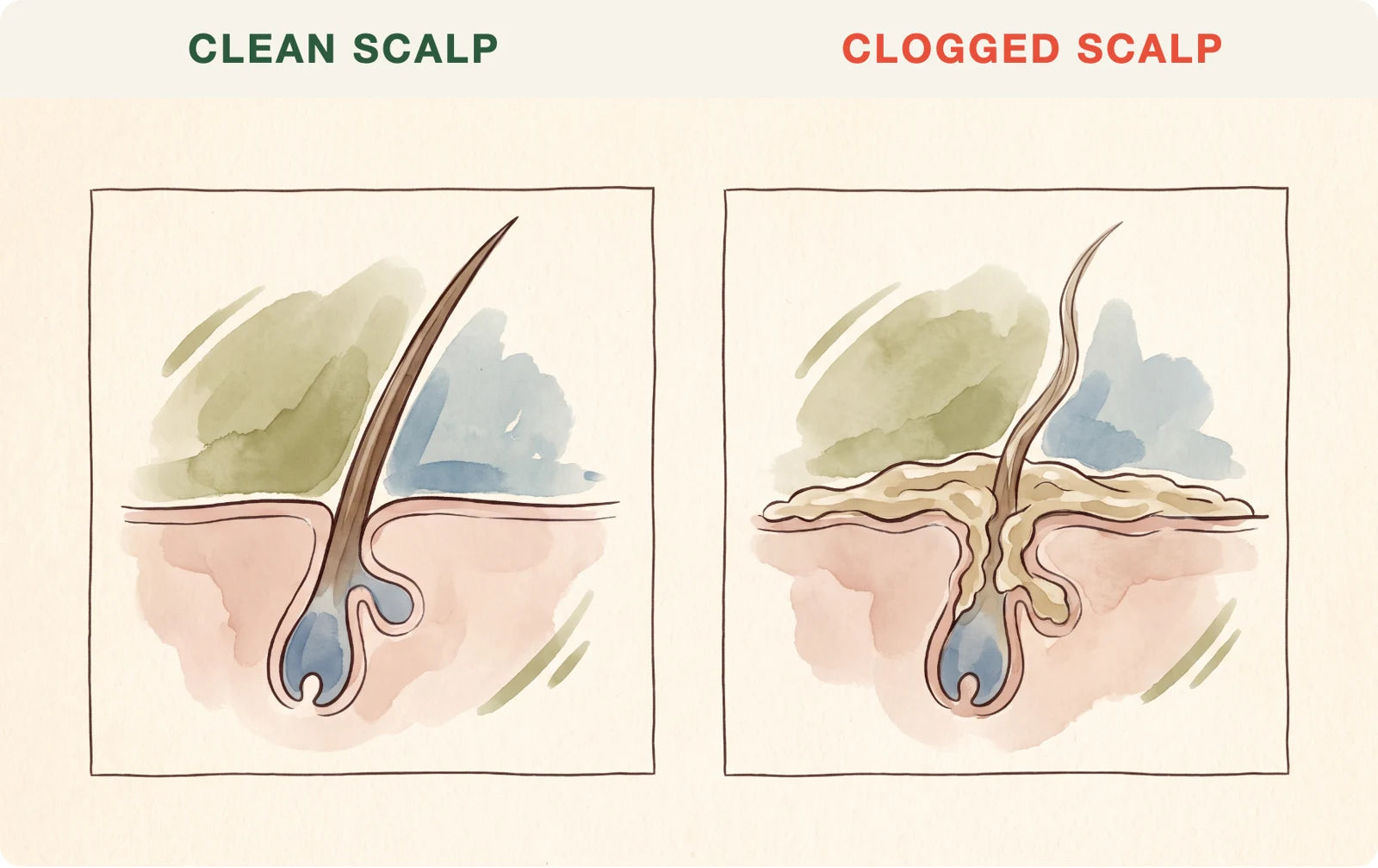 Clean scalp vs clogged scalp