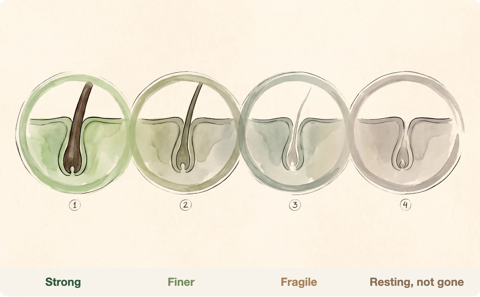 Miniaturization stages